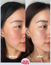 Load image into Gallery viewer, Skin Happy Hypochlorous Acid Face & Body Spray