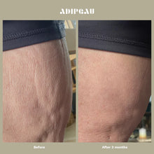 Load image into Gallery viewer, Adipeau Strong Body Gel