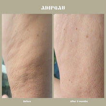 Load image into Gallery viewer, Adipeau Strong Body Gel