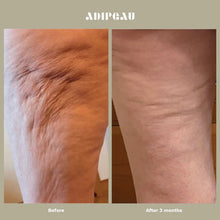 Load image into Gallery viewer, Adipeau Strong Body Gel