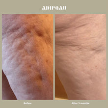 Load image into Gallery viewer, Adipeau Strong Body Gel