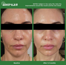 Load image into Gallery viewer, Adipeau Active face Cream