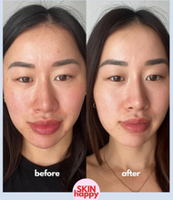 Load image into Gallery viewer, Skin Happy Hypochlorous Acid Face &amp; Body Spray
